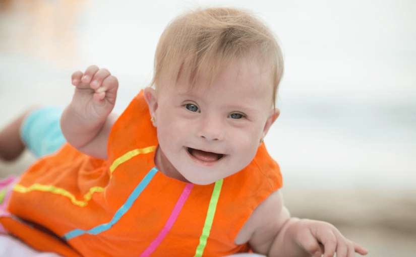 ダウン症の赤ちゃんの特徴とは？エコー診断や赤ちゃん体操の方法について